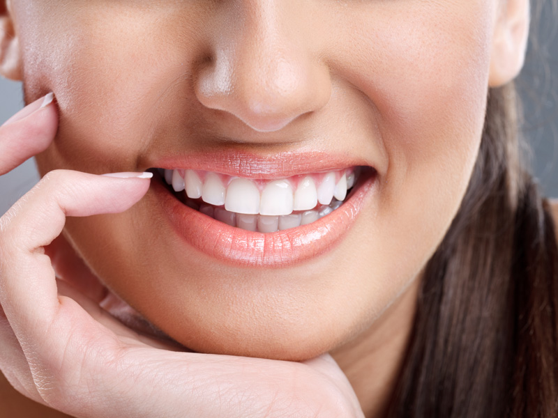 Estetica Dentale
